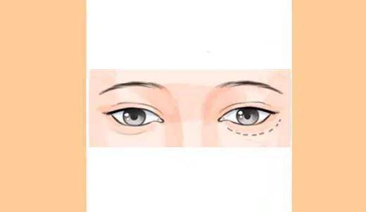 成语目什么交睫_倒睫是什么样子图片(3)