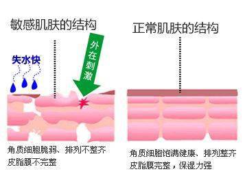 受试者|敏感肌修复化妆品免费试用咯！本中心现有一款敏感肌修复喷雾招募受试者！想改善皮肤敏感的女性朋友快来报名哦！