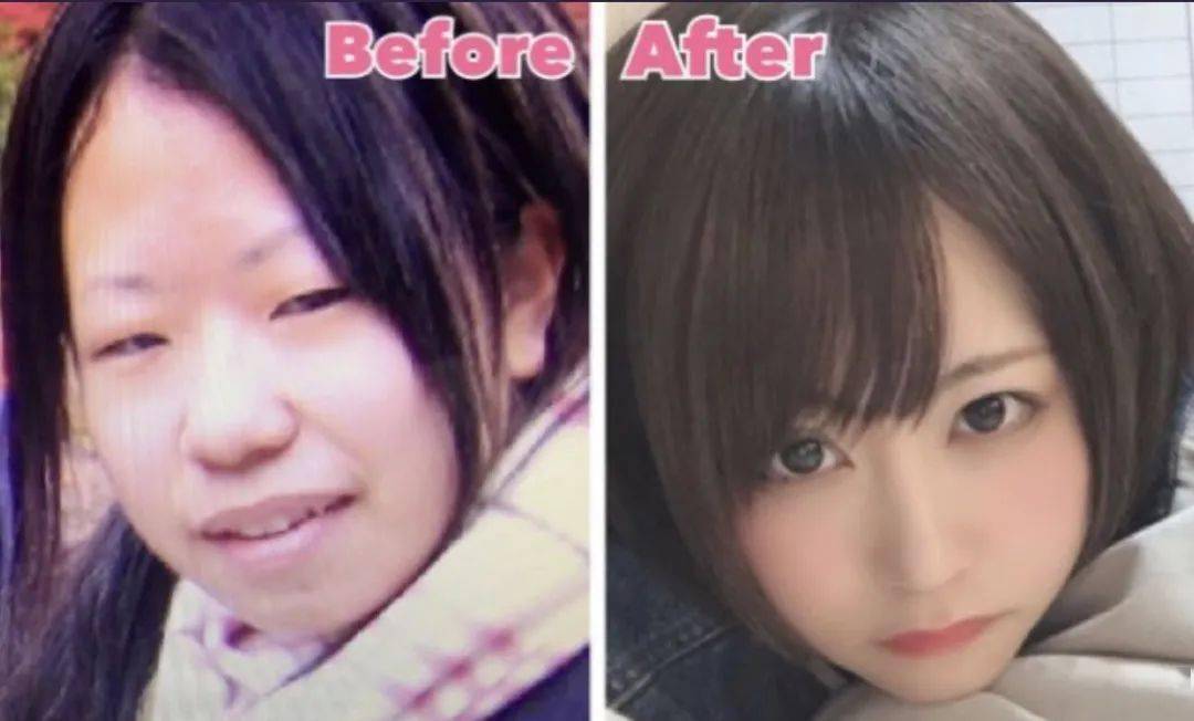 太丑|因被diss“太丑”花400万整容，宅女逆袭成新垣结衣？