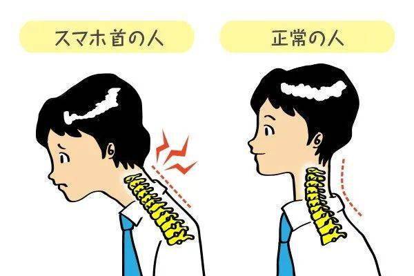 脖子背面疼 aa8ce54992a84fe8a8487caa4e624f8e.jpeg
