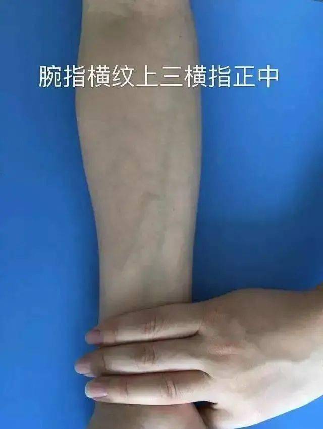 皮试时在患者前臂掌侧横纹上 3 横指正中与腕横纹皮肤平行进针,因为