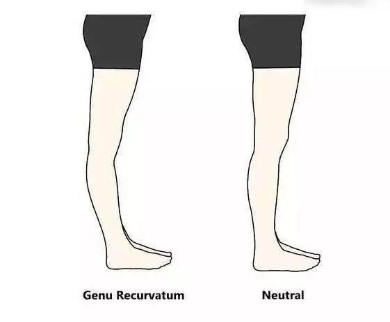 锻炼|赵丽颖再上热搜，锻炼生图线条感十足！更抓眼球的，是女神绝美的体态！