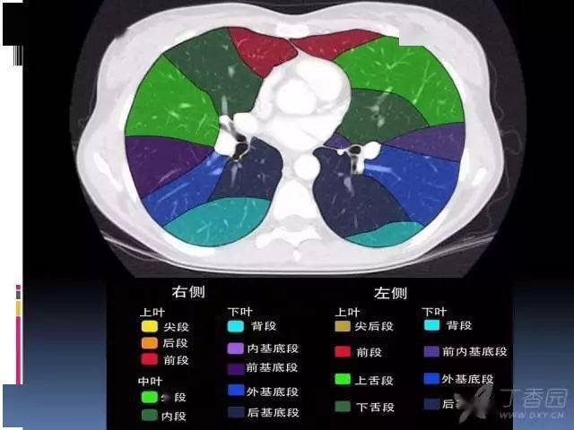 ct入门丨肺叶分段ct高清图谱