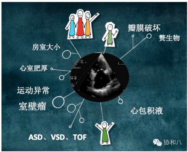 读片|不慌不忙，我也是超声心动读片王 | 朝花夕拾 · 协和八