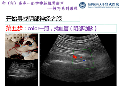 阴部|和（何）亮亮一起学超声技巧系列：超声引导阴部神经阻滞