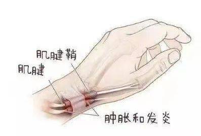 510aa80b73a340dc818c9b3d20085590.jpeg
