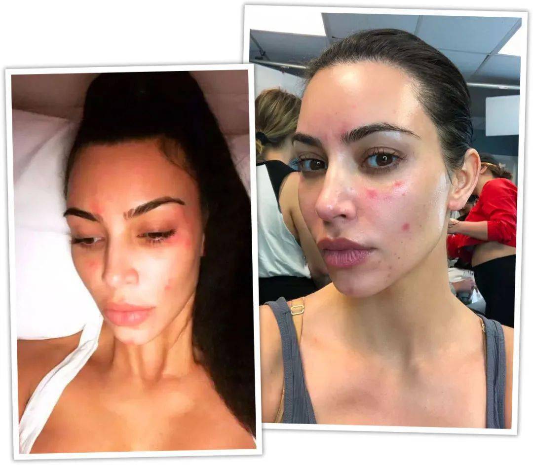 皮肤|第一瓶贵妇面霜怎么选？