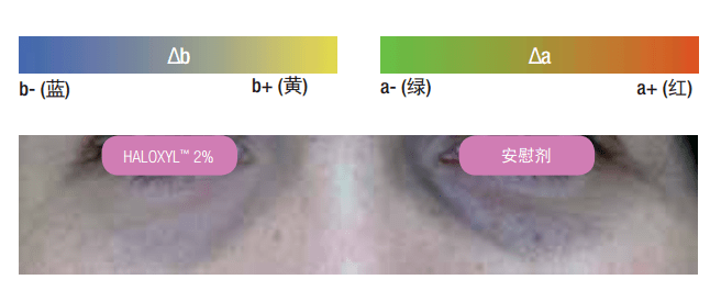近照|曾经红极一时的“最美港姐”近照曝光，原来美人真的能被一个细节毁掉.......