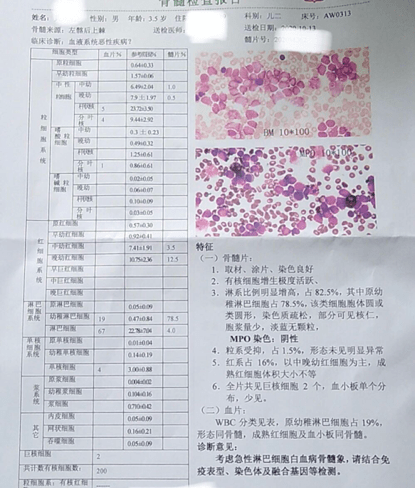 3 确诊急淋 第二天早上 9 时许,外周血涂片回报提示可见 19% 的幼稚