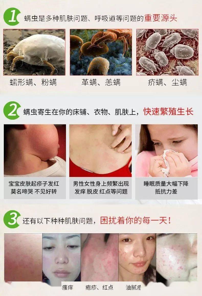 爬到皮肤上堵塞毛孔, 轻微的会出现瘙痒, 长黑头等问题, 严重了就会