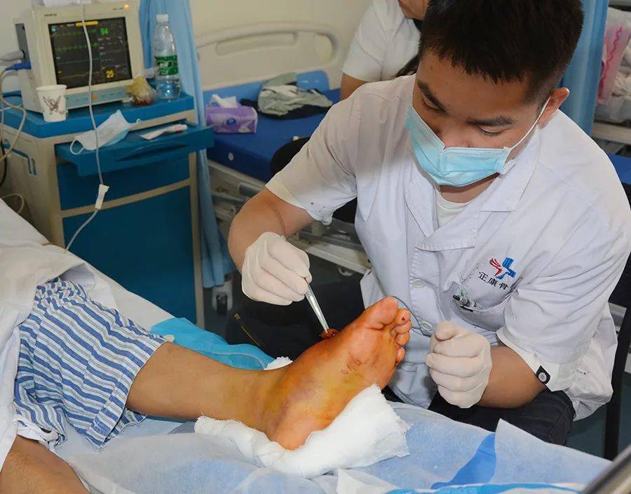 正康骨科专家告诉你:骨折后打了石膏注意啥?_手指