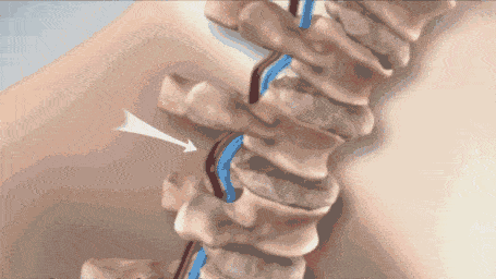 d104f433140d48c9b1244ffbd839057c.gif
