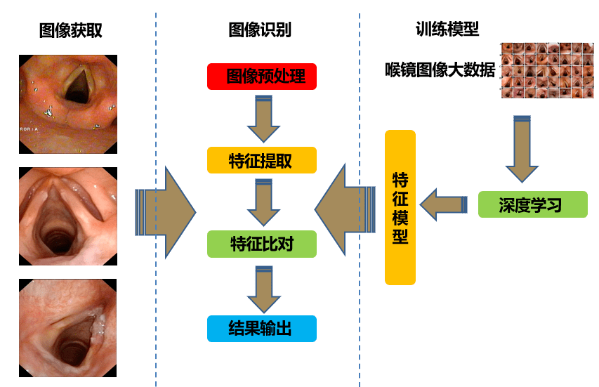 人工智能的全自动喉镜图像识别系统初探