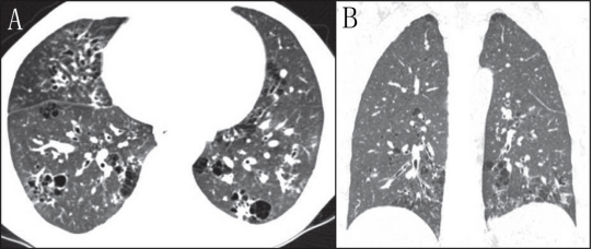 �����Է����Բ���ļ������