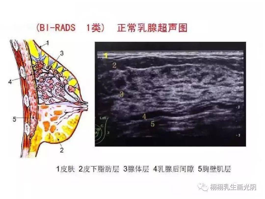 诊断| 秒懂乳腺超声报告单