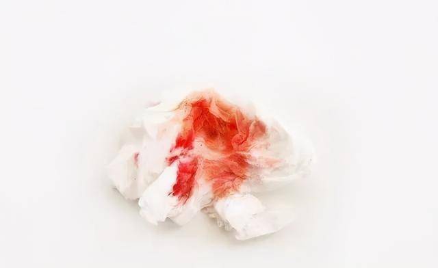 为何肺癌越来越多?医生提醒:注意身体5个信号,发现的