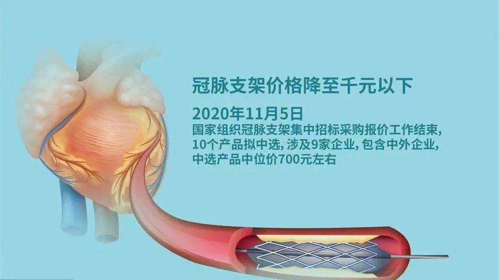 国家终于"出手"了,心脏支架降至地板价!