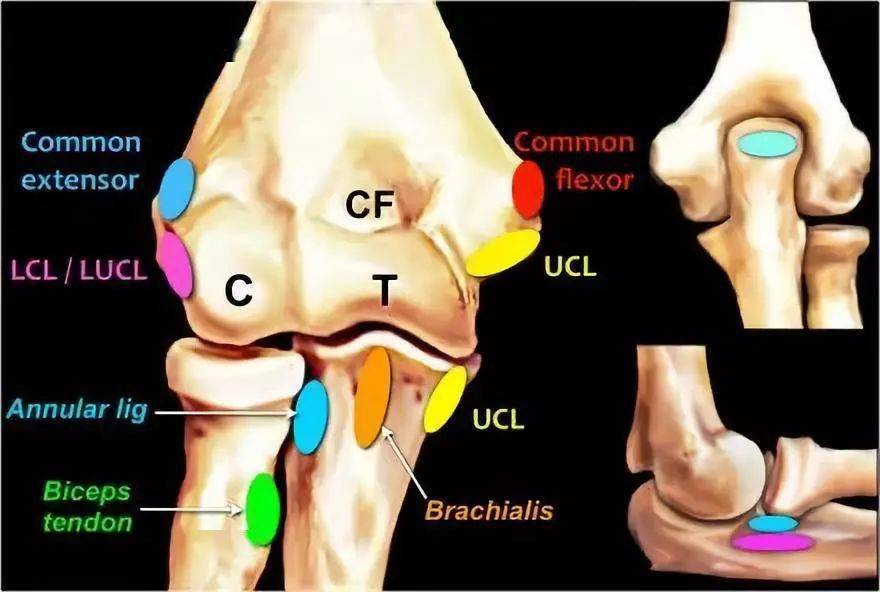肘关节mr解剖及疾病详解