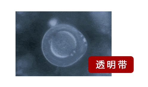一直以为自己是跑得最快的那颗精子,而现实竟是.