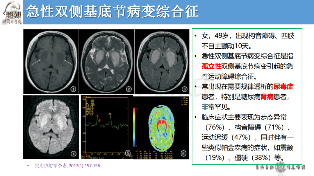 基底节区病变的影像与诊断