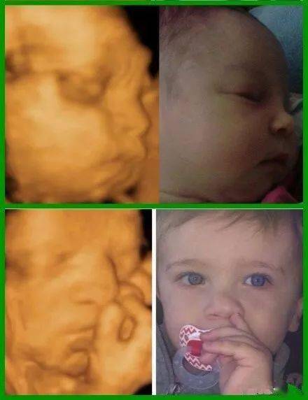 彩超排名_心脏彩超图片(3)