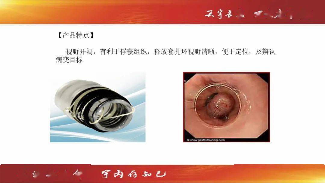 【呵护健康,关爱生命】天宇出品医疗器械系列介绍_套扎