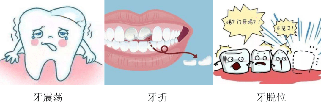 口腔科普牙外伤突袭而来该怎么正确处理呢