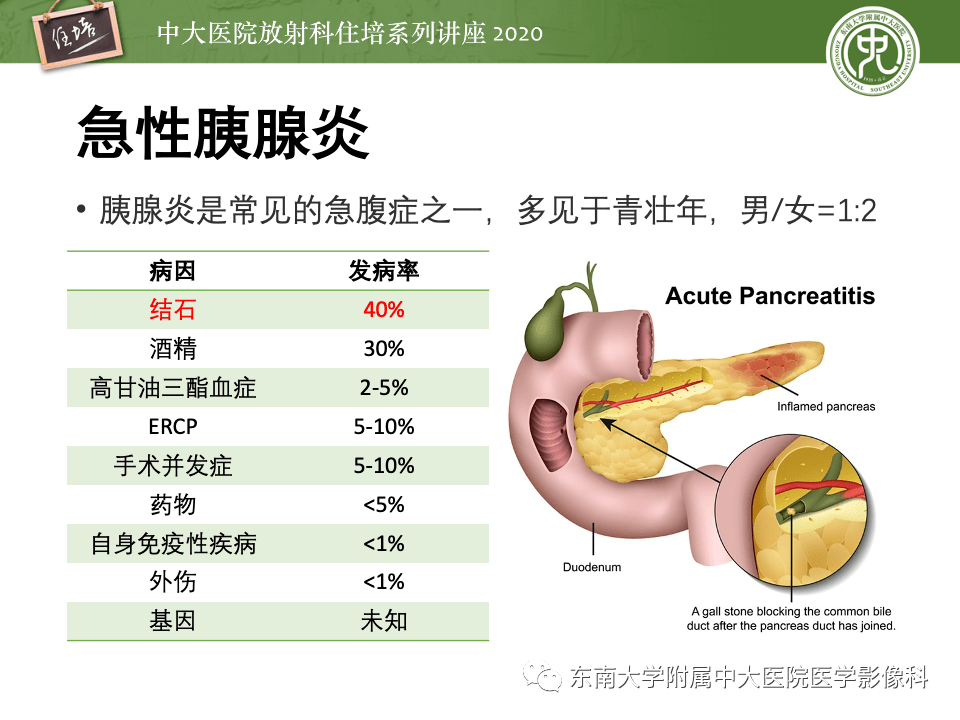 中大放射住培系列讲座十二指肠旁胰腺炎的影像评估及鉴别诊断