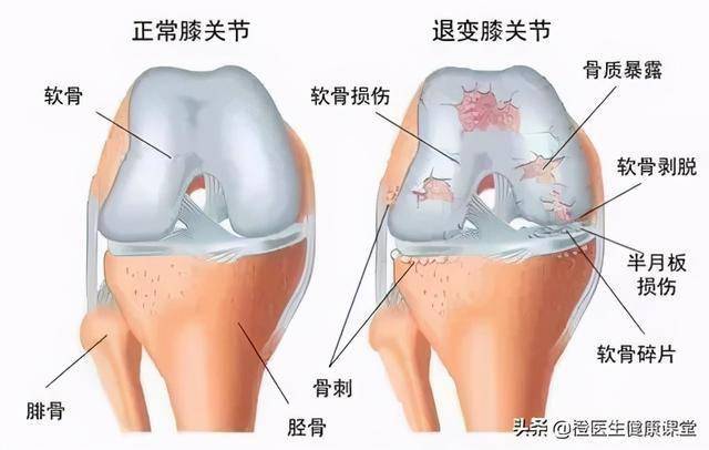 膝盖冻伤后疼怎么办