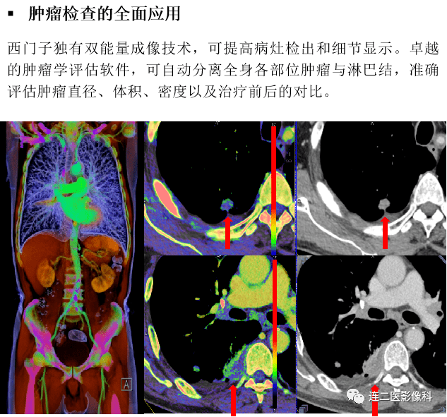 ct中的战斗机西门子超高端双源ct落户连二医