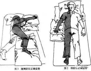 最全面的脑梗塞康复治疗总结