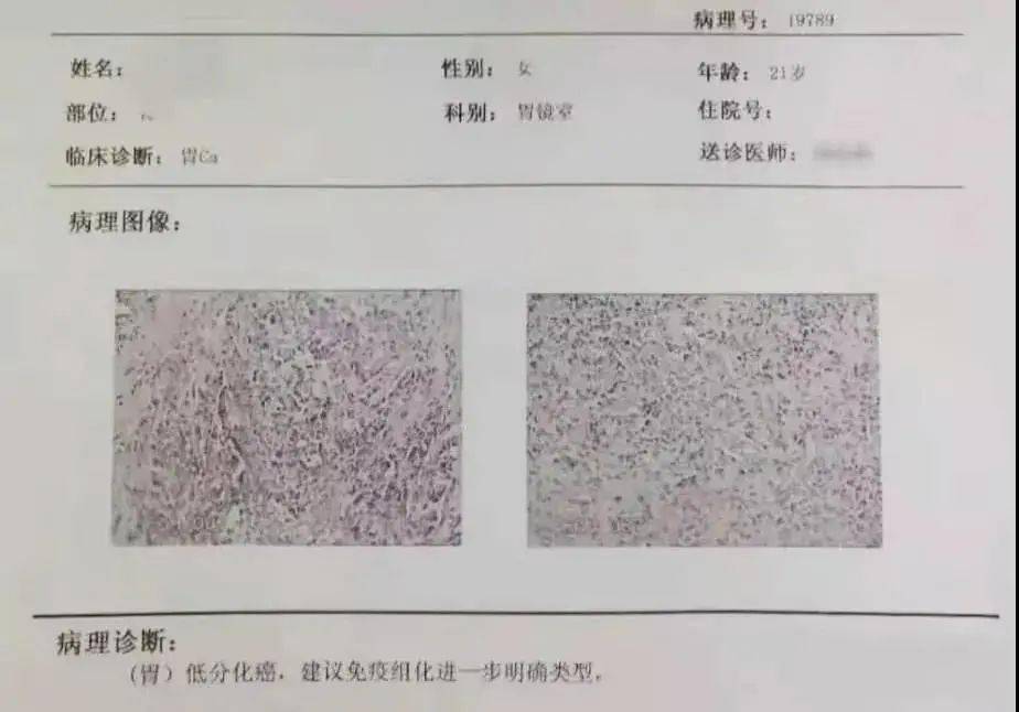 医生总结了3位年轻胃癌患者的病例30岁不到的他们到底干啥了