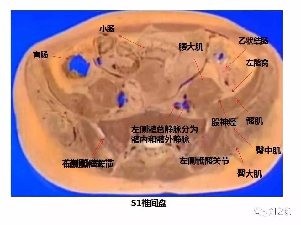 收藏必备:男性盆腔断层解剖