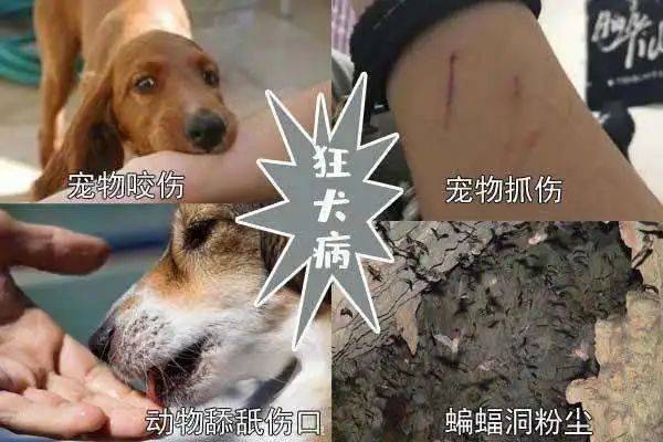 狂犬病是狂犬病毒属病毒感染引起的一种急性脑炎,是动物源性传染病.