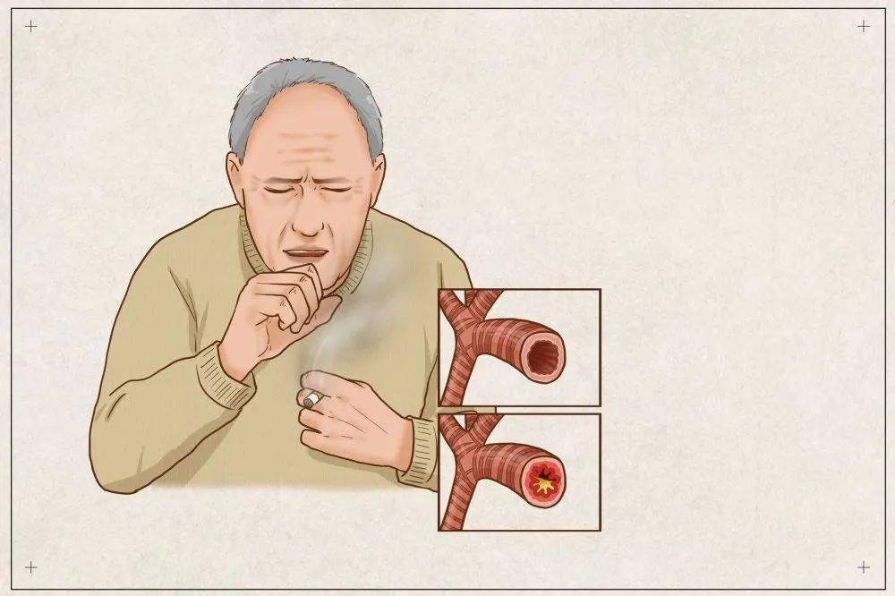 支气管炎医院排名_支气管炎医院证明