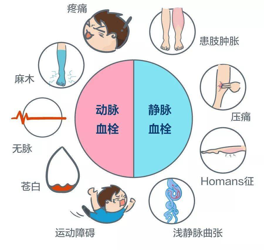 静脉血栓预防操及相关知识