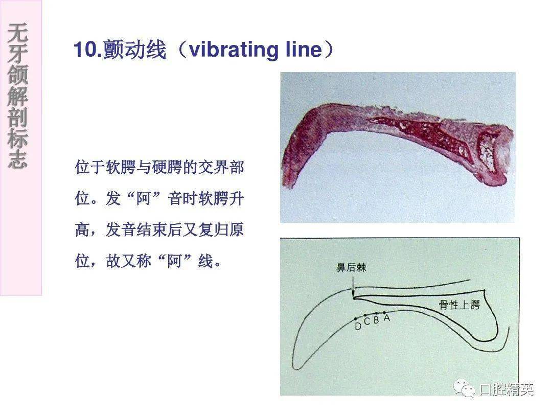 无牙颌解剖标志