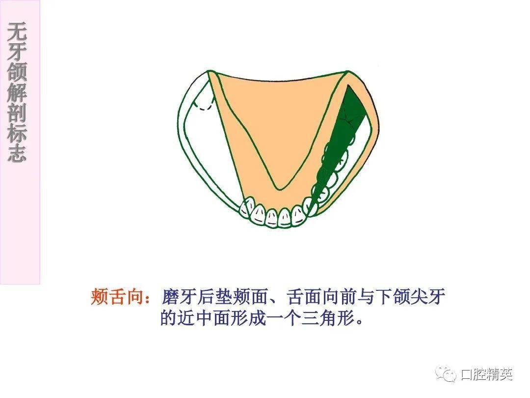 无牙颌解剖标志