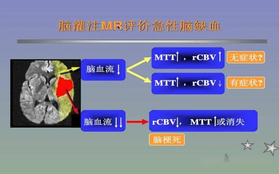 磁共振灌注成像的临床应用