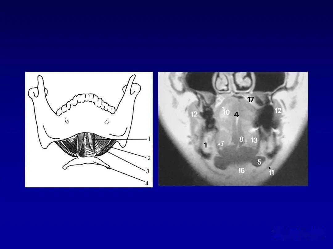 颌面部解剖及其病变的影像诊断