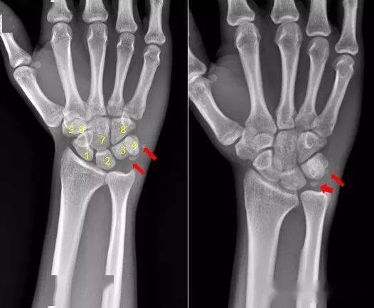 什么叫三角骨 44d061d89d154bdfb9059d193d1e9685.jpeg