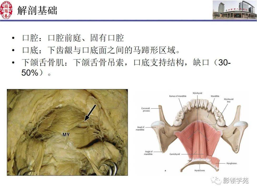 舌口底影像解剖及常见疾病诊断