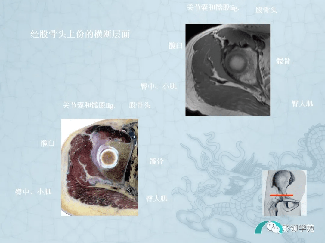 四肢断面解剖及影像