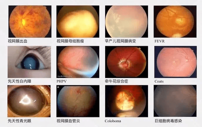 送给新生儿宝宝的第一份礼物