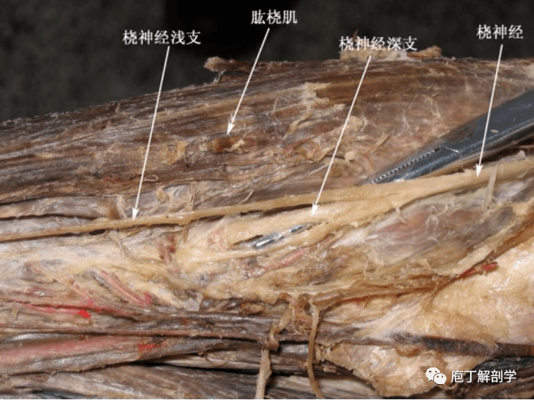 总动脉,经骨间膜近侧缘进入前臂后区,在浅,深层之间伴骨间后神经下行