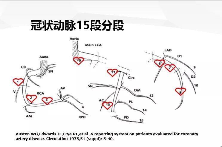 右束支来源于第一间隔支供血房室结动脉80%来于右冠状动脉,20%来源于