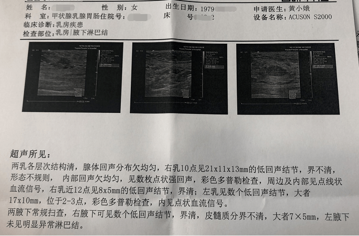 体检查出乳腺结节到底要不要再做检查听听甲乳外科主任怎么说