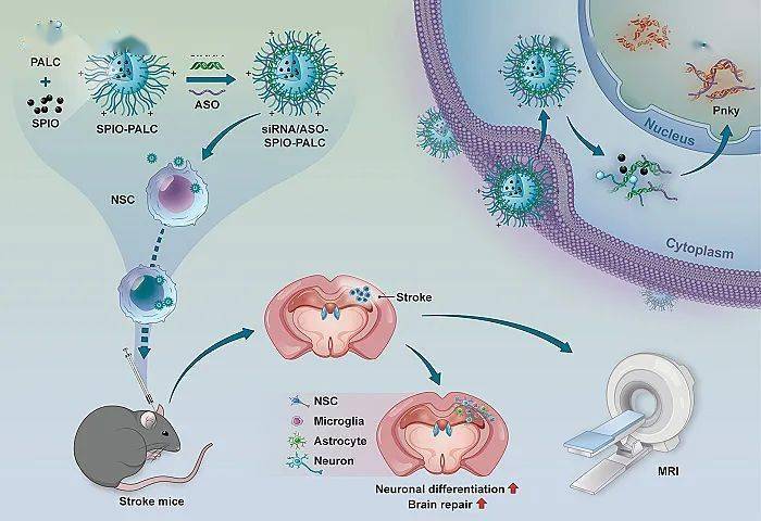 纳米医药通过沉默长非编码rna引导神经干细胞分化为神经元用于脑