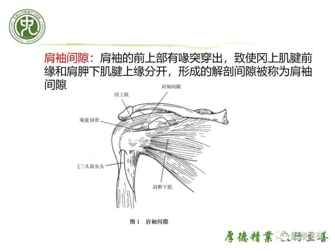 其中一个是腋囊增厚,其包括下盂肱韧带和沿着盂肱关节囊下部的较长