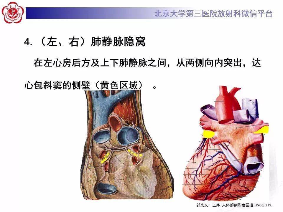 心包窦及心包隐窝解剖